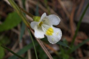 脂肪吸引の出血量が多い場合の危険基準は何mLですか？