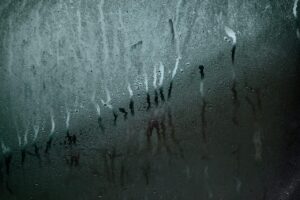 脂肪吸引当日の注意事項として知っておくべき食事と水分の制限は？