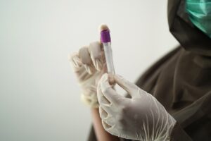脂肪吸引術前に必須の血液検査項目とは？